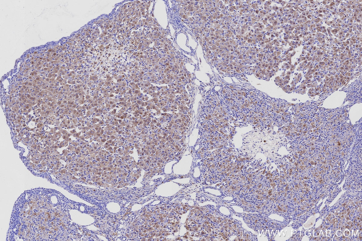 Immunohistochemical analysis of paraffin-embedded rat ovary tissue slide using KHC3119 (KIAA1468 IHC Kit). Immunohistochemical analysis of paraffin-embedded rat ovary tissue slide using KHC3119 (KIAA1468 IHC Kit).