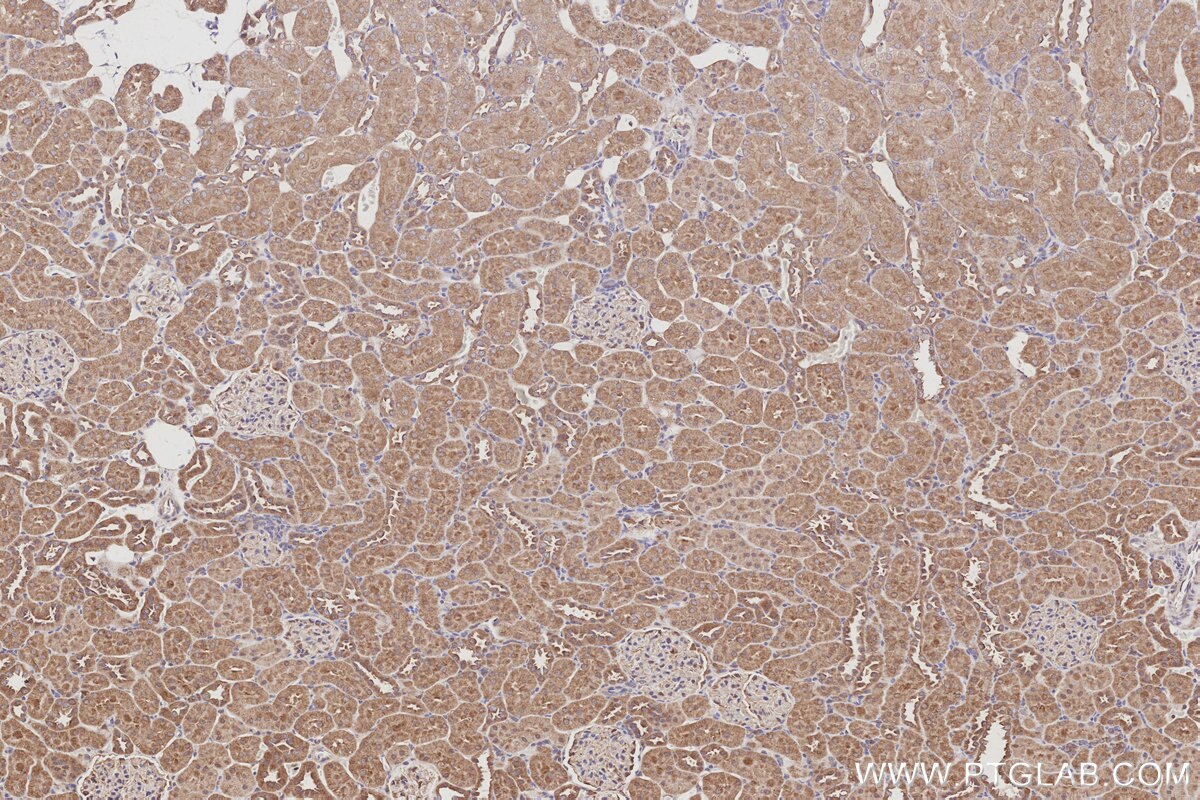 Immunohistochemical analysis of paraffin-embedded rat kidney tissue slide using KHC3036 (KIDINS220 IHC Kit). Immunohistochemical analysis of paraffin-embedded rat kidney tissue slide using KHC3036 (KIDINS220 IHC Kit).