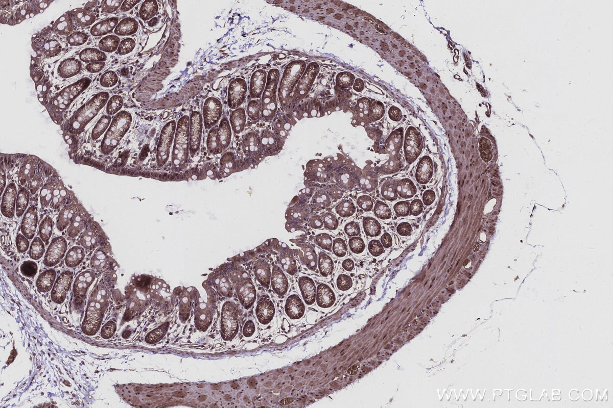 Immunohistochemical analysis of paraffin-embedded mouse colon tissue slide using KHC2951 (KIF15 IHC Kit).
