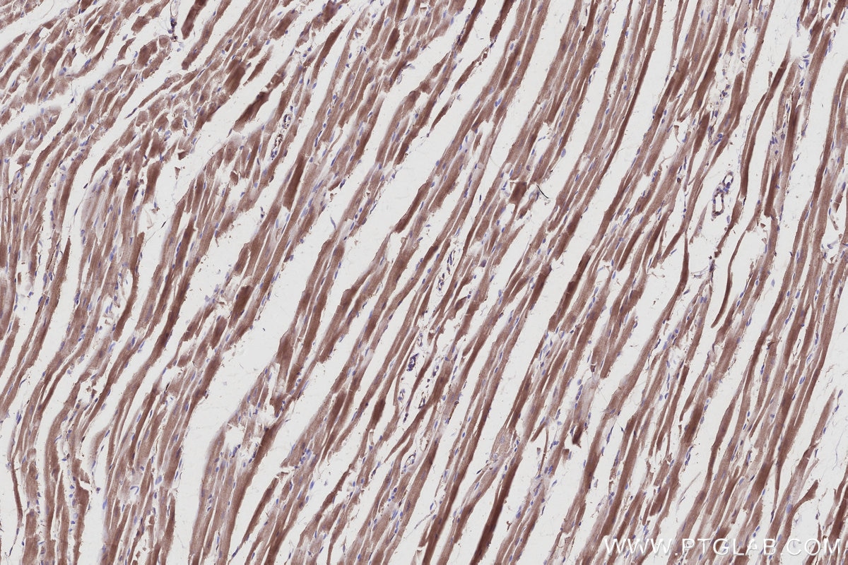 Immunohistochemical analysis of paraffin-embedded rat heart tissue slide using KHC2951 (KIF15 IHC Kit).