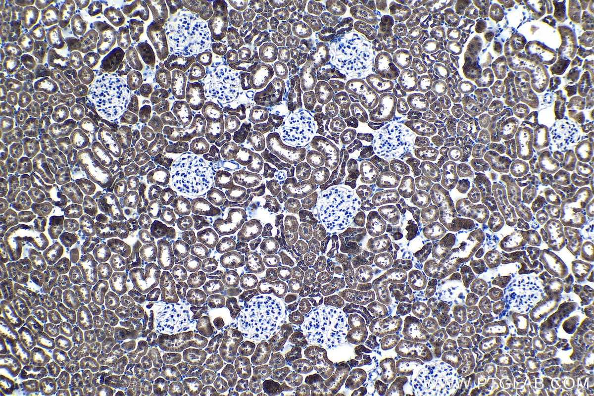 Immunohistochemical analysis of paraffin-embedded rat kidney tissue slide using KHC1223 (KIF18A IHC Kit).