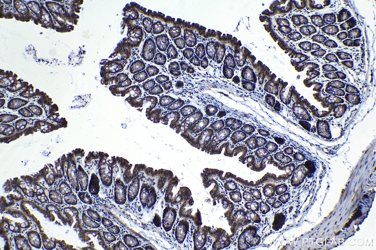 Immunohistochemical analysis of paraffin-embedded mouse colon tissue slide using KHC1223 (KIF18A IHC Kit).