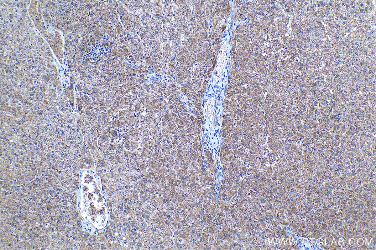 Immunohistochemical analysis of paraffin-embedded human liver tissue slide using KHC1223 (KIF18A IHC Kit).