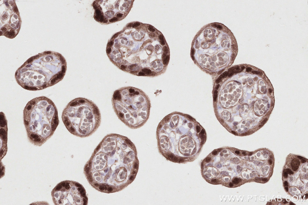 Immunohistochemical analysis of paraffin-embedded human placenta tissue slide using KHC2820 (KIF20B IHC Kit).