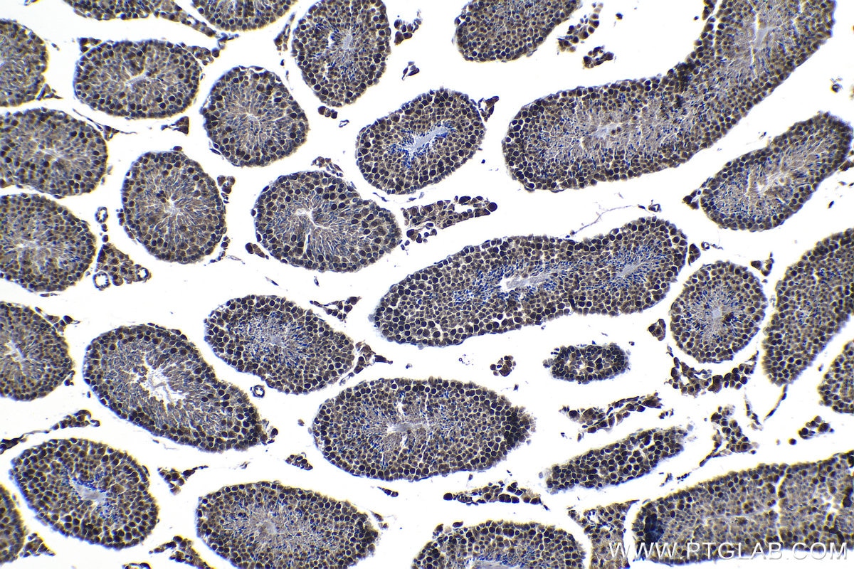 Immunohistochemical analysis of paraffin-embedded mouse testis tissue slide using KHC1255 (KIF22 IHC Kit).