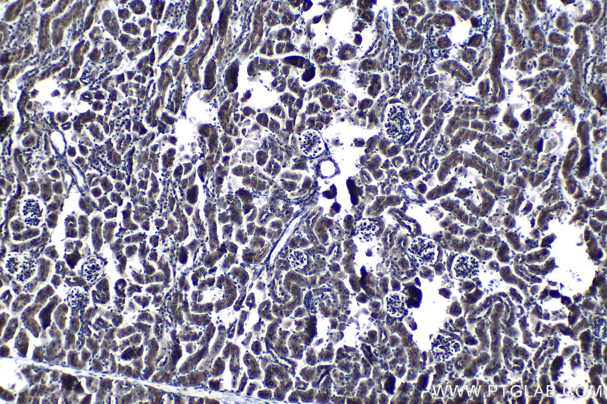 Immunohistochemical analysis of paraffin-embedded mouse kidney tissue slide using KHC1268 (KIF26B IHC Kit).