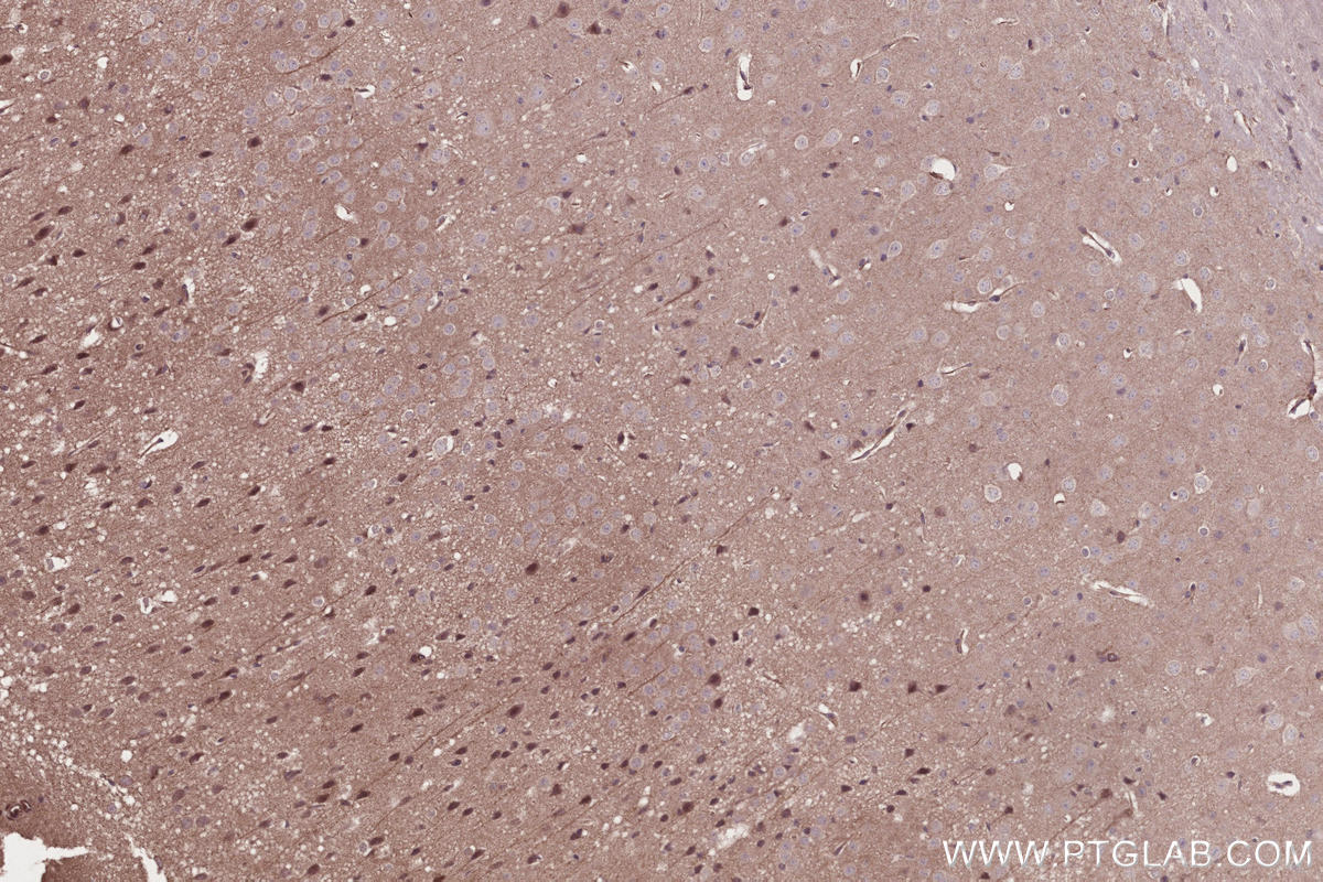 Immunohistochemical analysis of paraffin-embedded mouse brain tissue slide using KHC2674 (KIF2B IHC Kit).