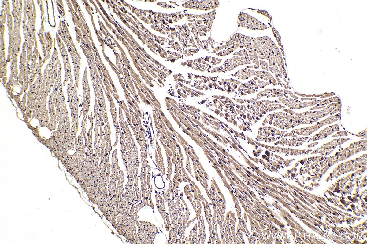 Immunohistochemical analysis of paraffin-embedded mouse heart tissue slide using KHC2104 (KIN IHC Kit).