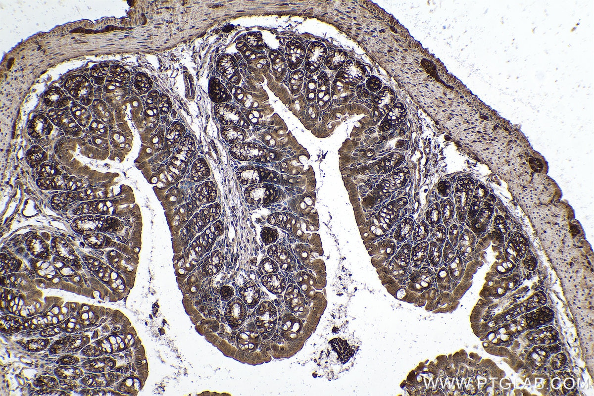 Immunohistochemical analysis of paraffin-embedded mouse colon tissue slide using KHC0963 (KLC2 IHC Kit).