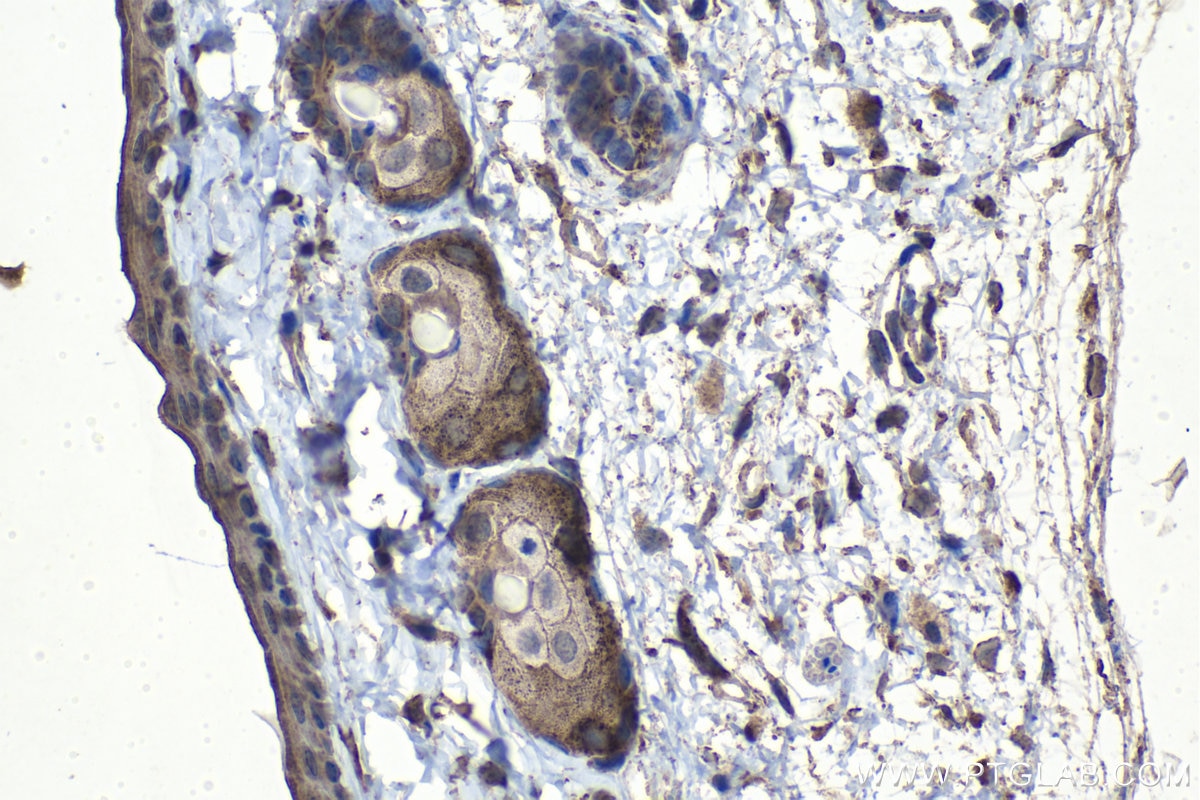 Immunohistochemical analysis of paraffin-embedded mouse skin tissue slide using KHC1110 (KLK11 IHC Kit).