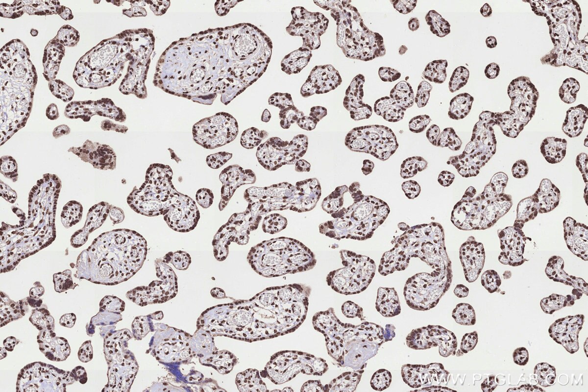 Immunohistochemical analysis of paraffin-embedded human placenta tissue slide using KHC3298 (KMT2C IHC Kit).
