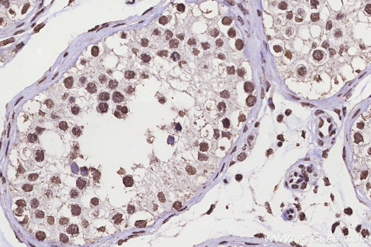 Immunohistochemical analysis of paraffin-embedded human testis tissue slide using KHC3298 (KMT2C IHC Kit).