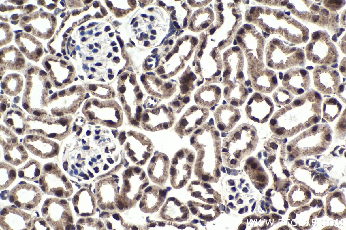Immunohistochemical analysis of paraffin-embedded mouse kidney tissue slide using KHC1827 (KMT2E/MLL5 IHC Kit).
