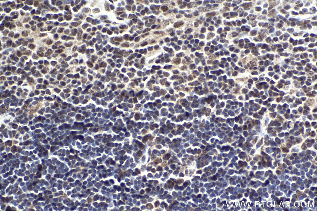 Immunohistochemical analysis of paraffin-embedded mouse thymus tissue slide using KHC1827 (KMT2E/MLL5 IHC Kit).