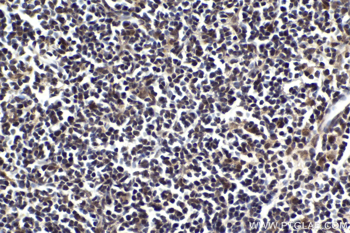 Immunohistochemical analysis of paraffin-embedded rat thymus tissue slide using KHC1827 (KMT2E/MLL5 IHC Kit).