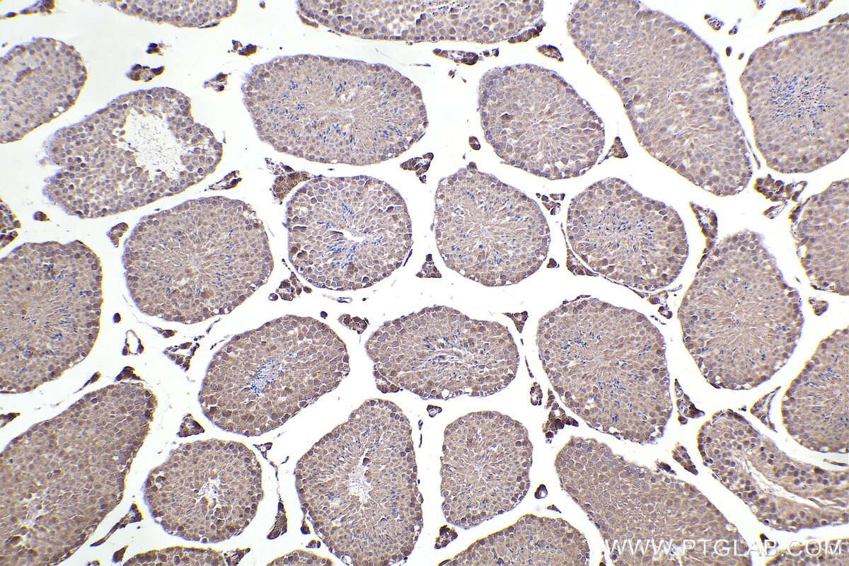 Immunohistochemical analysis of paraffin-embedded mouse testis tissue slide using KHC2298 (KNTC1 IHC Kit).