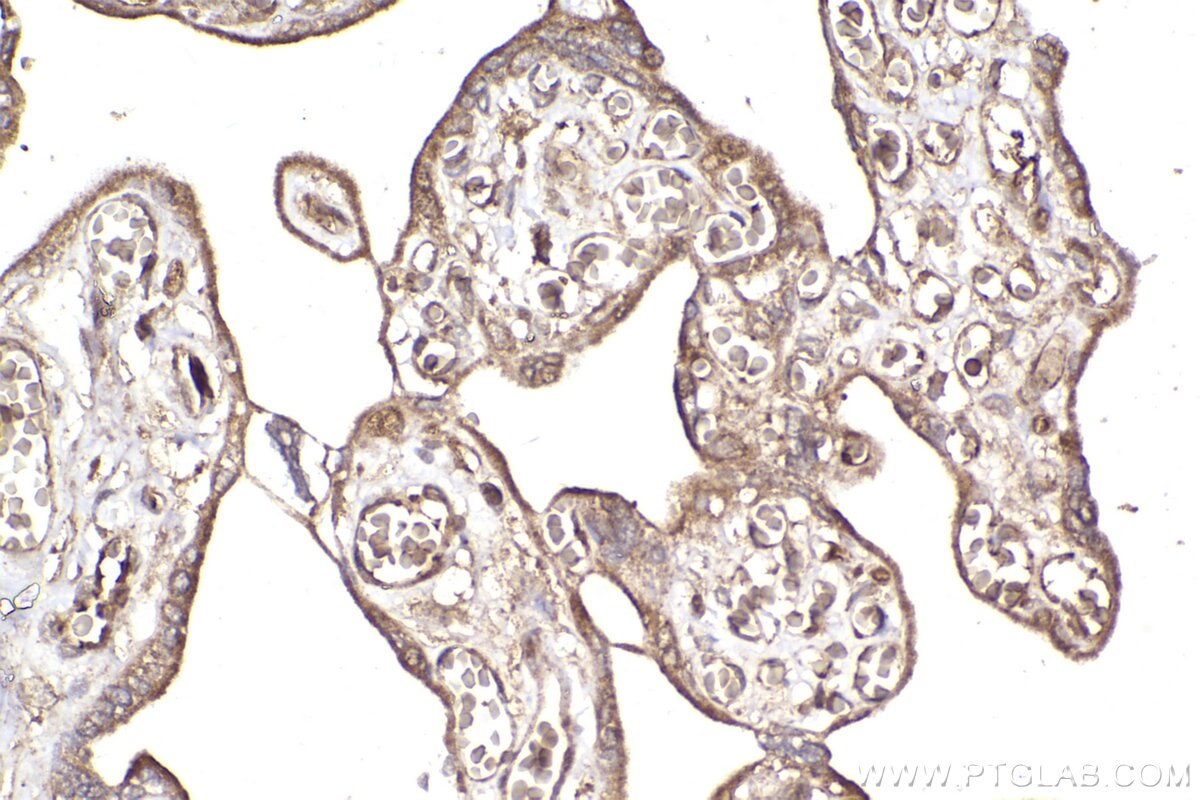 Immunohistochemical analysis of paraffin-embedded human placenta tissue slide using KHC2298 (KNTC1 IHC Kit).