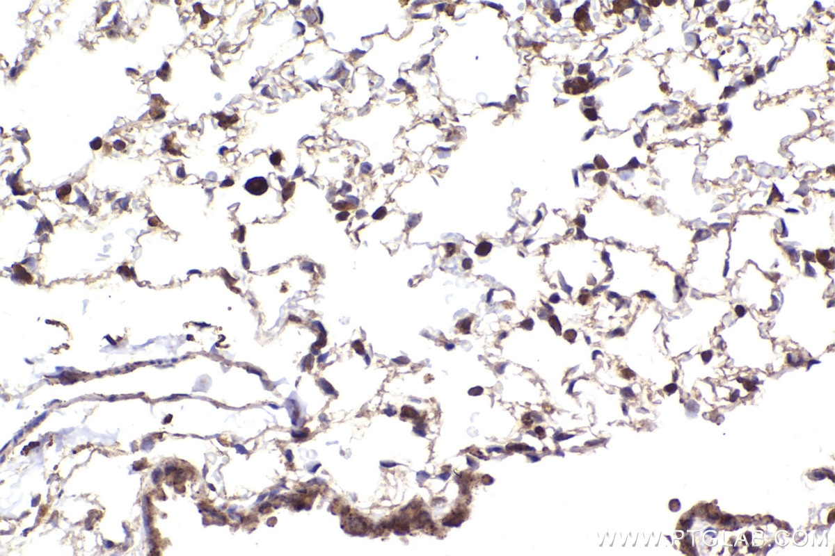 Immunohistochemical analysis of paraffin-embedded mouse lung tissue slide using KHC2298 (KNTC1 IHC Kit).