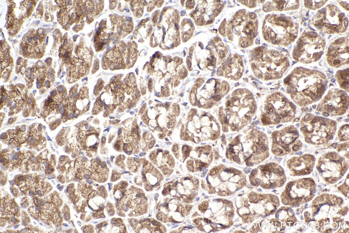 Immunohistochemical analysis of paraffin-embedded rat stomach tissue slide using KHC2298 (KNTC1 IHC Kit).