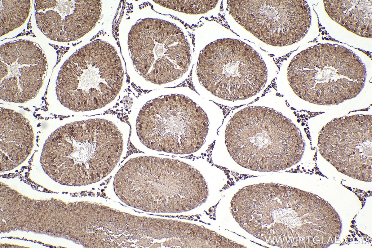 Immunohistochemical analysis of paraffin-embedded rat testis tissue slide using KHC2298 (KNTC1 IHC Kit).