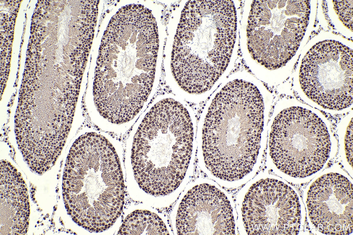 Immunohistochemical analysis of paraffin-embedded rat testis tissue slide using KHC2310 (KPNA1 IHC Kit).