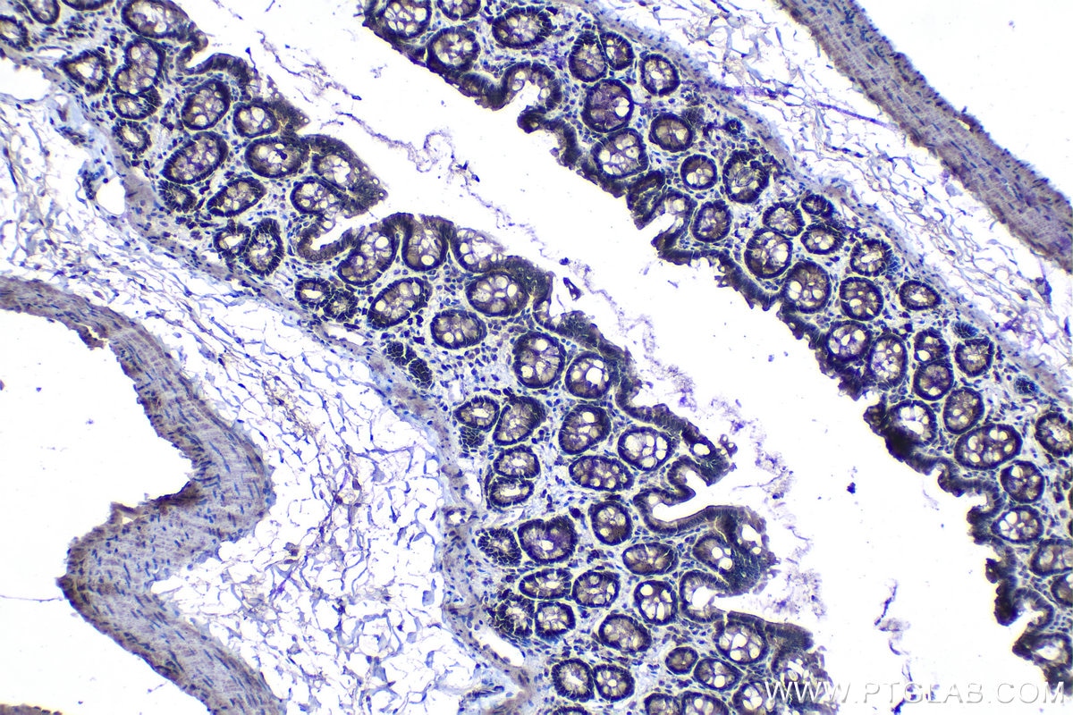 Immunohistochemical analysis of paraffin-embedded rat colon tissue slide using KHC1242 (KPNA3 IHC Kit).
