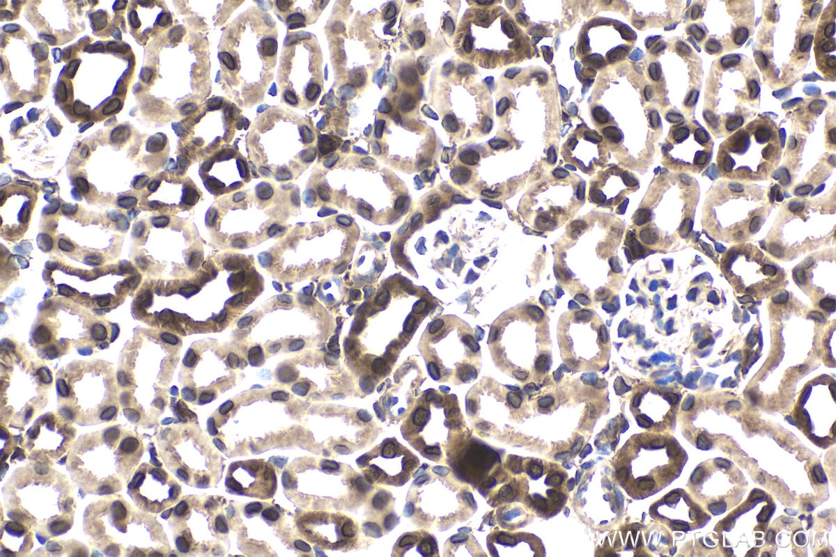 Immunohistochemical analysis of paraffin-embedded mouse kidney tissue slide using KHC1742 (KPNB1 IHC Kit).