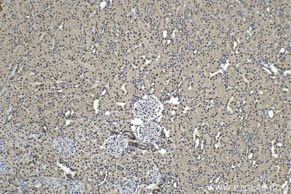 Immunohistochemical analysis of paraffin-embedded rat kidney tissue slide using KHC1742 (KPNB1 IHC Kit).