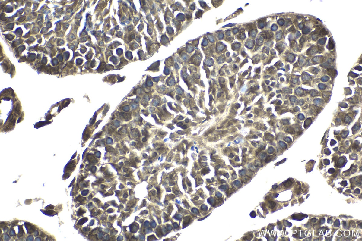 Immunohistochemical analysis of paraffin-embedded mouse testis tissue slide using KHC1742 (KPNB1 IHC Kit).