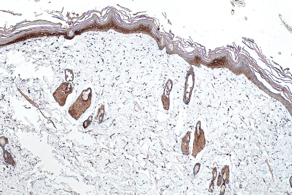 Immunohistochemical analysis of paraffin-embedded rat skin tissue slide using KHC0582 (KRT10 IHC Kit).