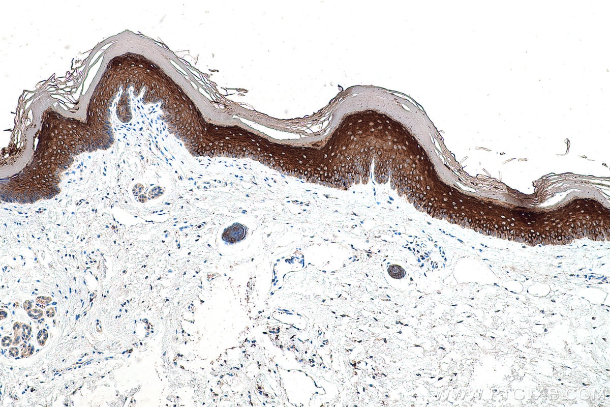 Immunohistochemical analysis of paraffin-embedded mouse skin tissue slide using KHC0582 (KRT10 IHC Kit).