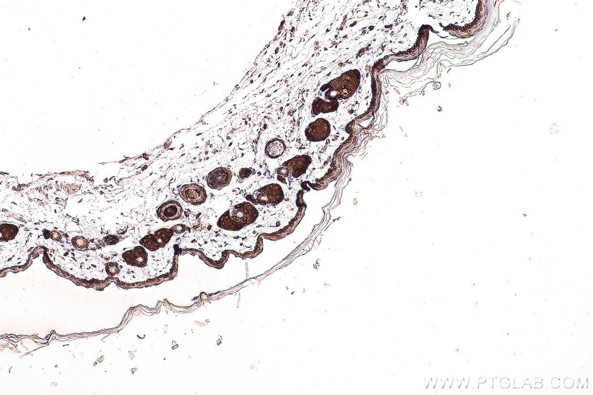 Immunohistochemical analysis of paraffin-embedded mouse skin tissue slide using KHC0751 (KRT14 IHC Kit).