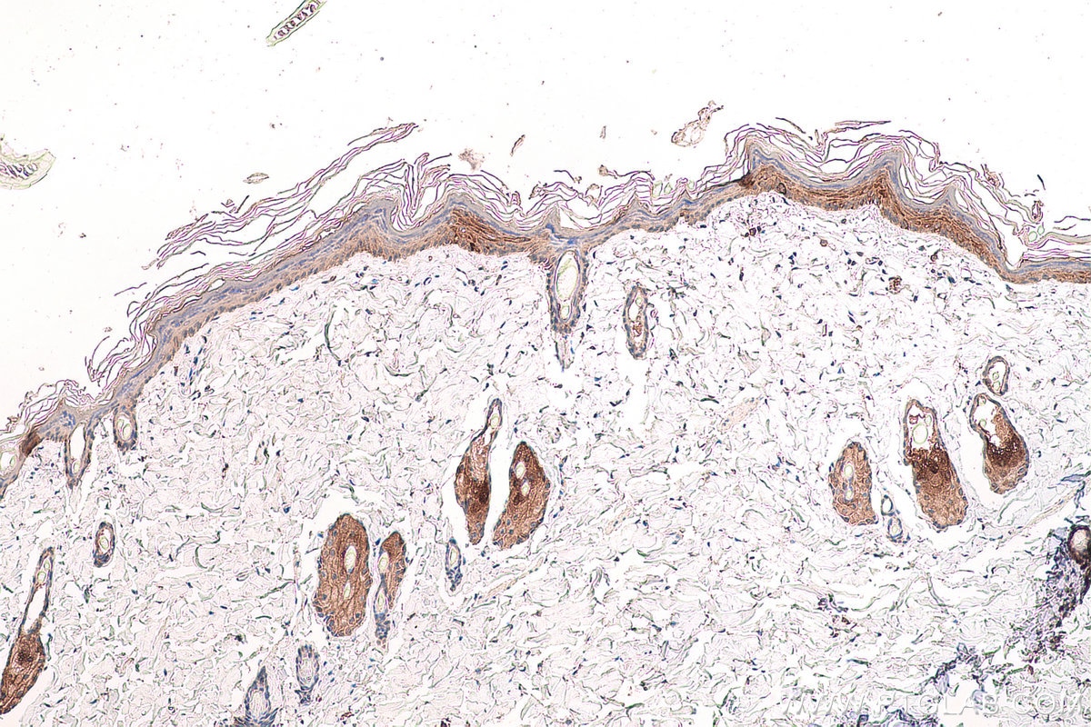 Immunohistochemical analysis of paraffin-embedded rat skin tissue slide using KHC0751 (KRT14 IHC Kit).