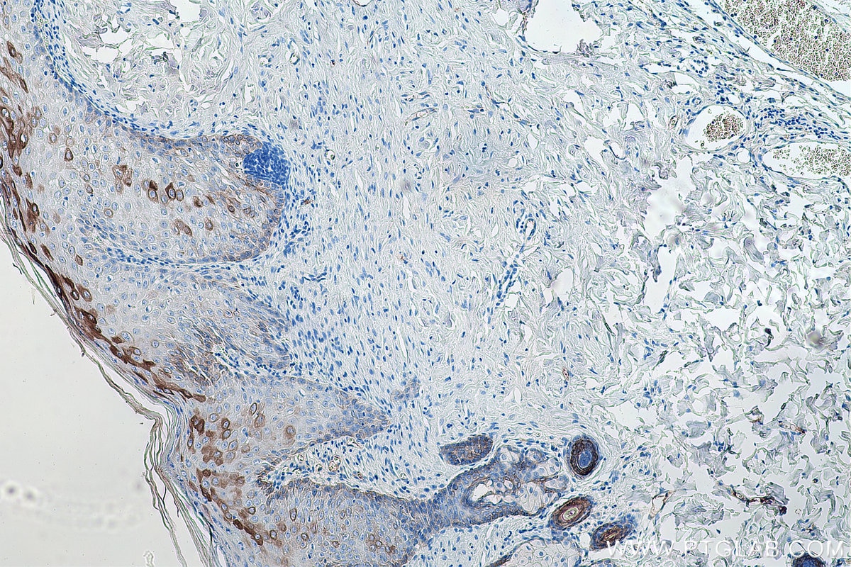 Immunohistochemical analysis of paraffin-embedded rat skin tissue slide using KHC0142 (Cytokeratin 16 IHC Kit).