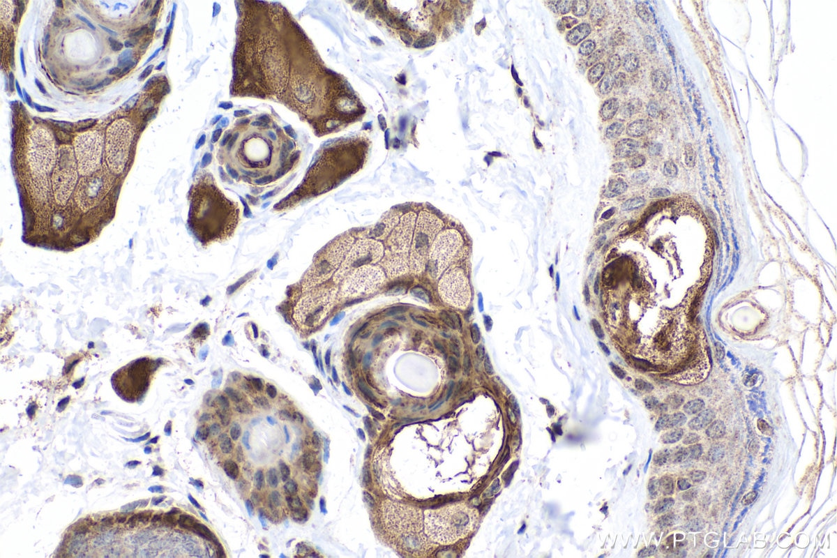 Immunohistochemical analysis of paraffin-embedded mouse skin tissue slide using KHC0753 (KRT17 IHC Kit).