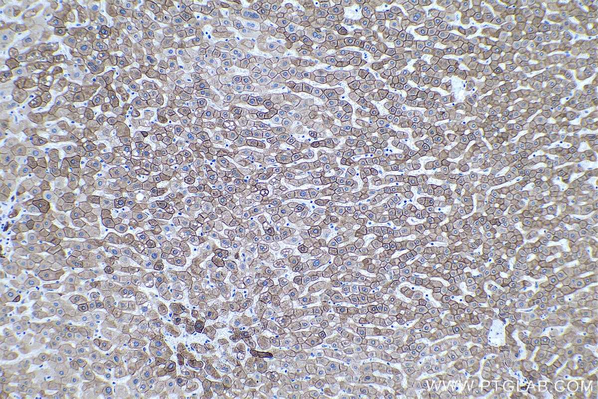 Immunohistochemical analysis of paraffin-embedded human liver tissue slide using KHC0032 (KRT18 IHC Kit).