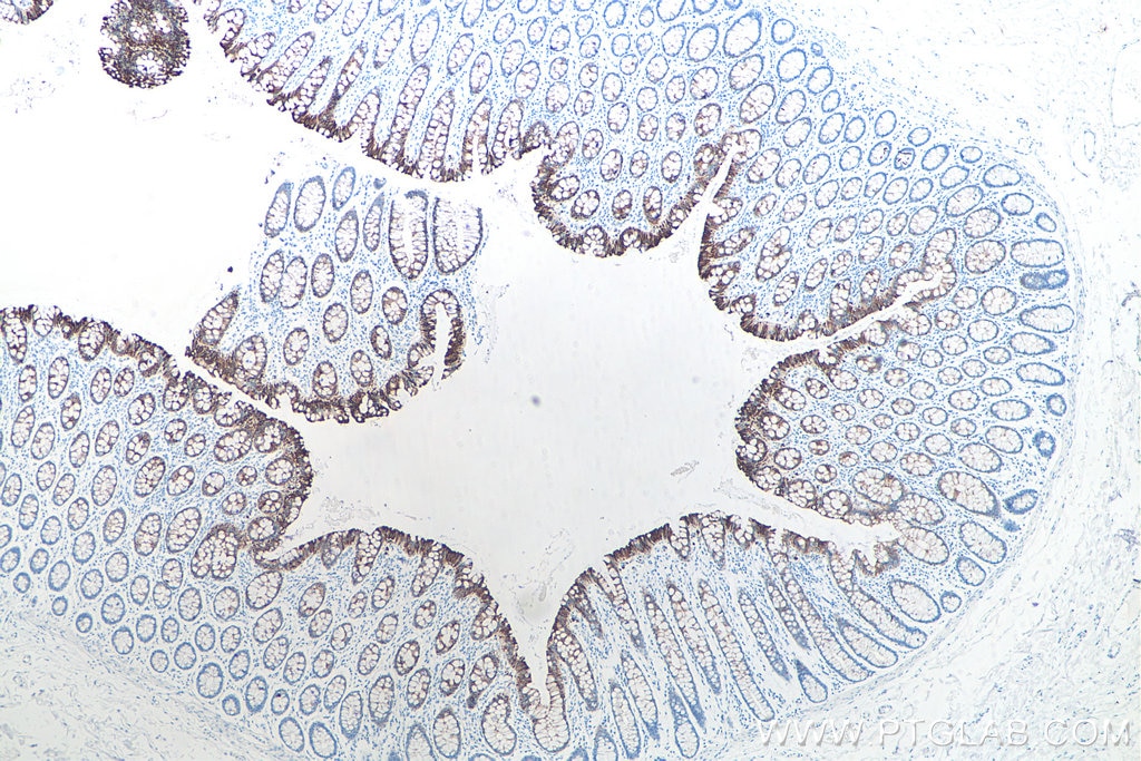 Immunohistochemical analysis of paraffin-embedded human colon tissue slide using KHC0033 (Cytokeratin 19 IHC Kit).