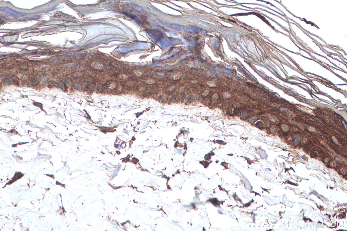 Immunohistochemical analysis of paraffin-embedded rat skin tissue slide using KHC0745 (KRT2 IHC Kit).