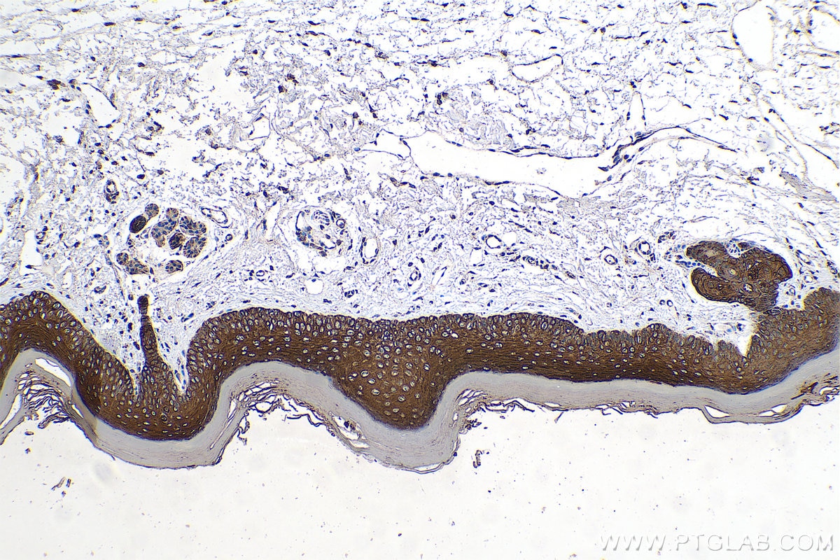 Immunohistochemical analysis of paraffin-embedded mouse skin tissue slide using KHC0754 (KRT33B IHC Kit).