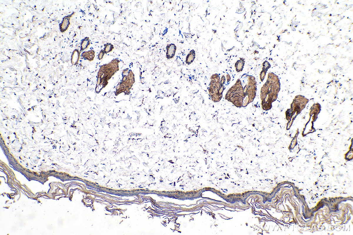 Immunohistochemical analysis of paraffin-embedded rat skin tissue slide using KHC0754 (KRT33B IHC Kit).