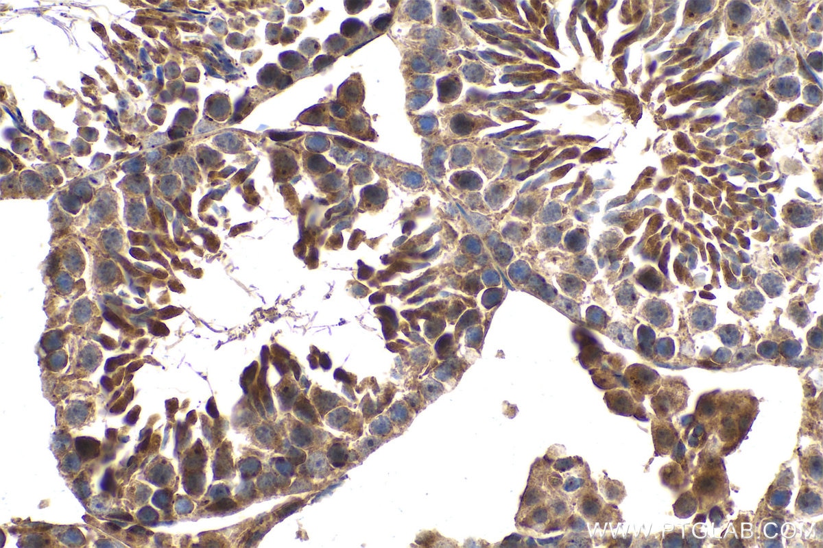 Immunohistochemical analysis of paraffin-embedded mouse testis tissue slide using KHC0755 (KRT34 IHC Kit).