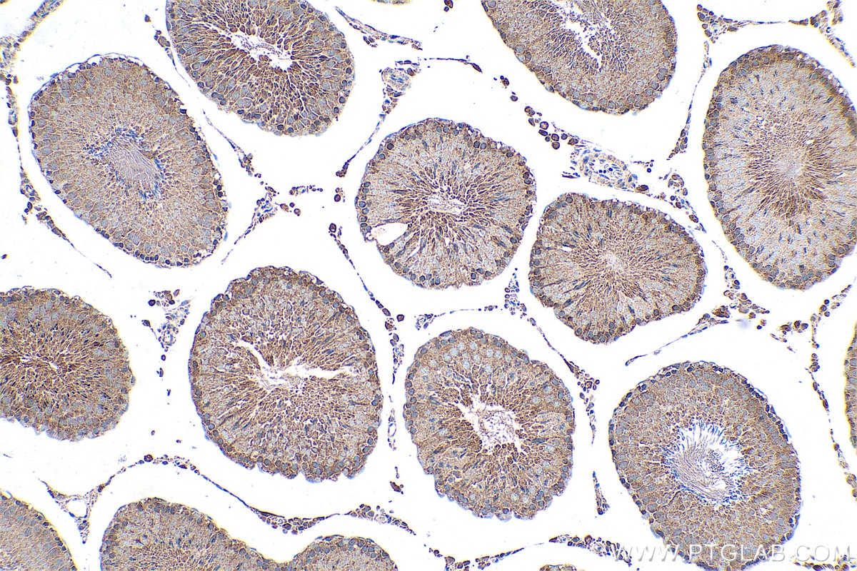 Immunohistochemical analysis of paraffin-embedded rat testis tissue slide using KHC0755 (KRT34 IHC Kit).