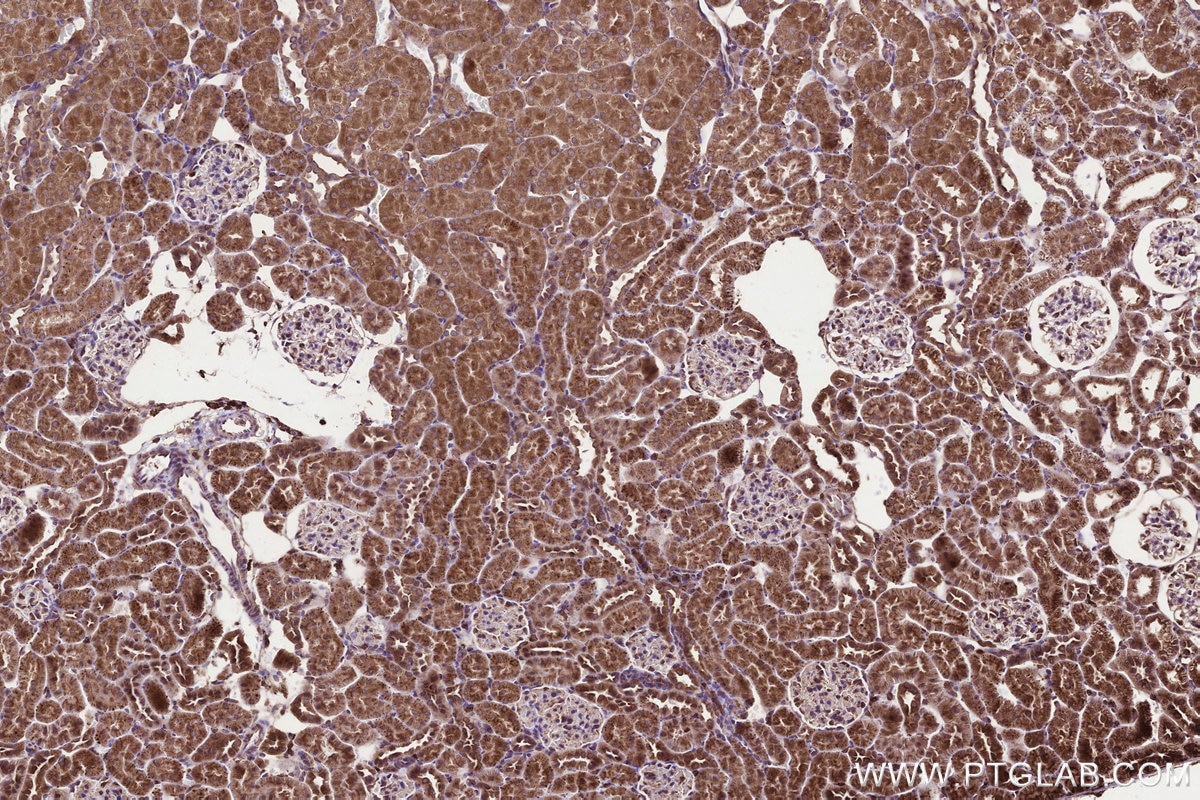 Immunohistochemical analysis of paraffin-embedded rat kidney tissue slide using KHC3292 (KTELC1 IHC Kit).
