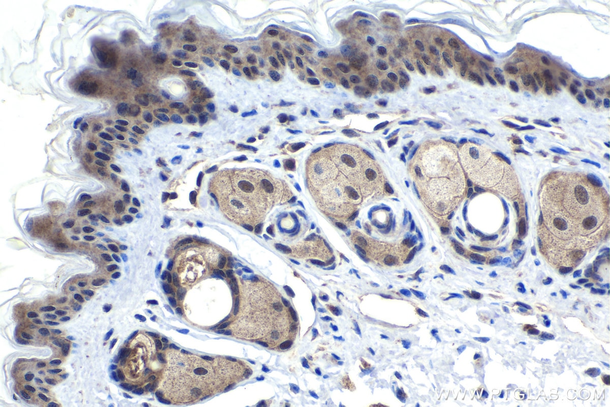 Immunohistochemical analysis of paraffin-embedded mouse skin tissue slide using KHC1785 (Kazrin IHC Kit).