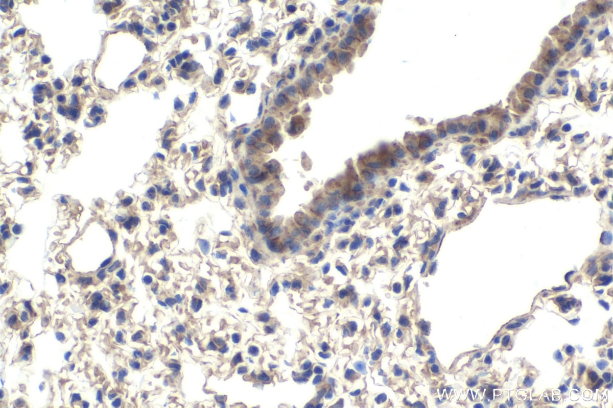 Immunohistochemical analysis of paraffin-embedded mouse lung tissue slide using KHC1785 (Kazrin IHC Kit).