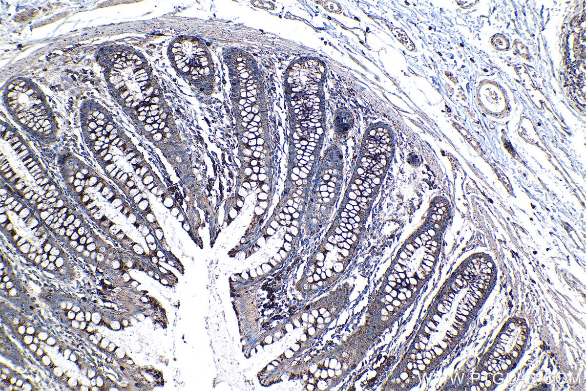 Immunohistochemical analysis of paraffin-embedded human colon tissue slide using KHC1336 (LAMP1/CD107a IHC Kit).