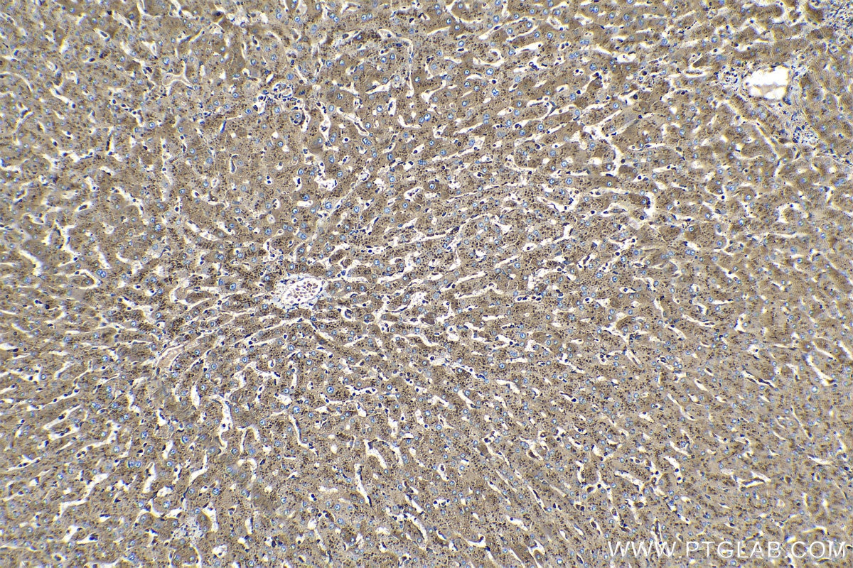 Immunohistochemical analysis of paraffin-embedded human liver tissue slide using KHC1336 (LAMP1/CD107a IHC Kit).