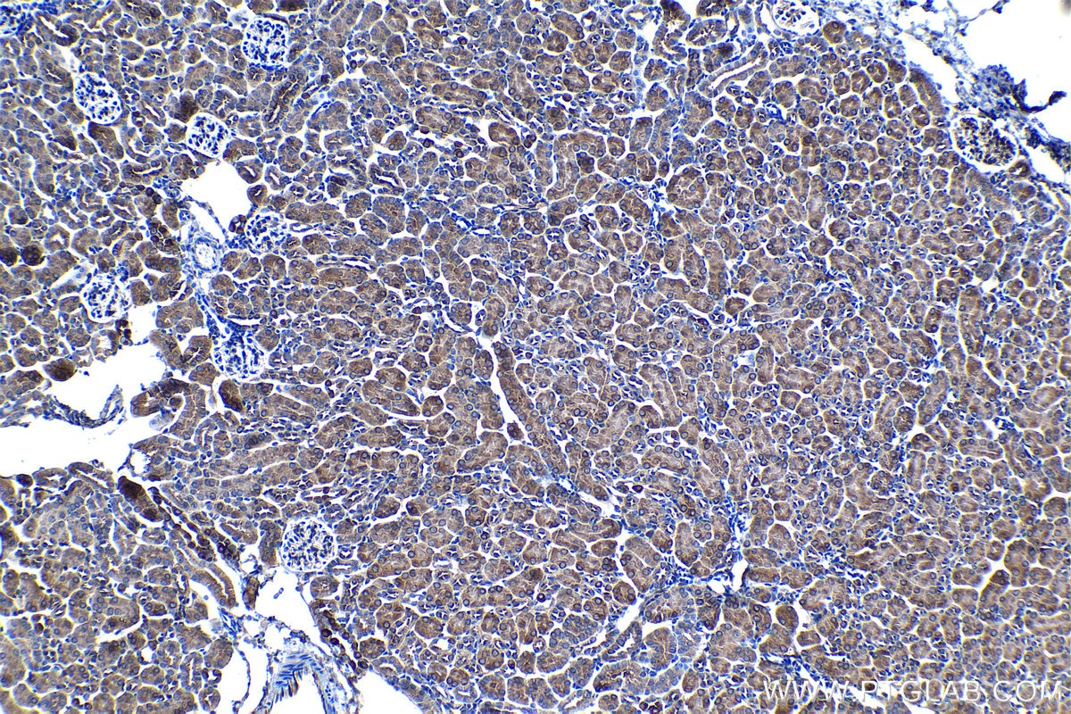Immunohistochemical analysis of paraffin-embedded mouse kidney tissue slide using KHC1363 (LAMP2 IHC Kit).