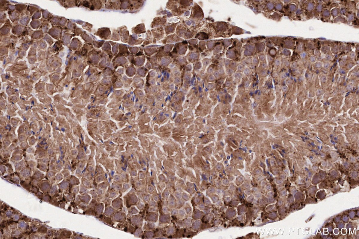 Immunohistochemical analysis of paraffin-embedded mouse testis tissue slide using KHC2577 (LAMTOR1 IHC Kit).