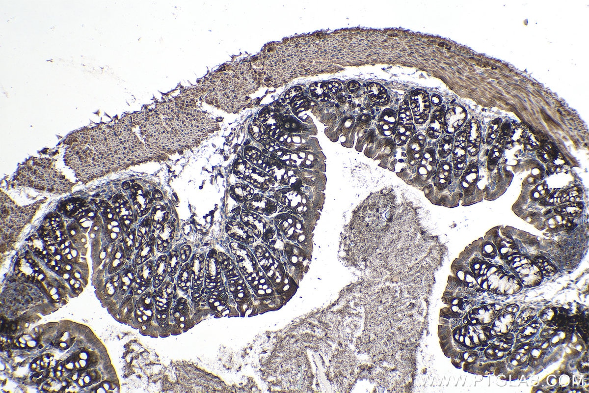 Immunohistochemical analysis of paraffin-embedded mouse colon tissue slide using KHC1005 (LARP1 IHC Kit).